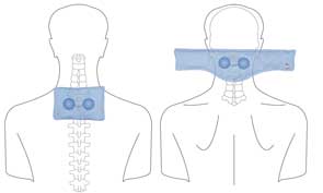 Pressure Point Cold Pack Diagram
